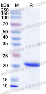 Recombinant Human CD224/GGT1 Protein, N-His