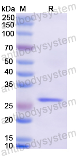 Recombinant Human FUT1 Protein, N-His
