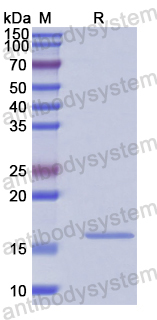 Recombinant Human EIF2S2 Protein, N-His