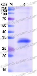 Recombinant Human ANXA7 Protein, N-His