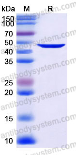 Recombinant Human ANXA7 Protein, Tag free