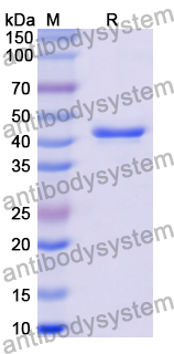 Recombinant Human CHRM3 Protein, N-His-KSI