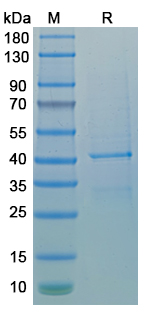 Recombinant Human RAB3B Protein, N-GST