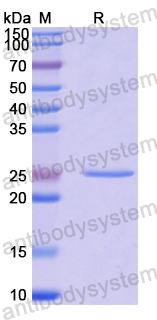 Recombinant Human TAC1 Protein, N-His-SUMO