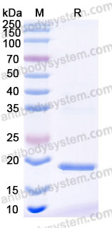 Recombinant Human TAC1 Protein, N-His