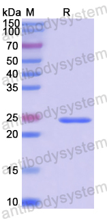 Recombinant Human PSMB1 Protein, N-His