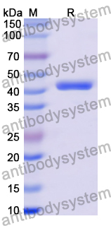 Recombinant Human LMNB1 Protein, N-GST & C-His