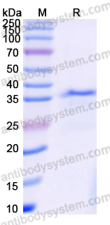 Recombinant Human CD11a/ITGAL Protein, N-His
