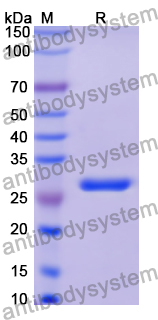 Recombinant Human BCL3 Protein, N-His