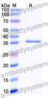 Recombinant Human FLG Protein, C-His