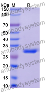 Recombinant Human PDC Protein, N-His
