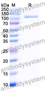 Recombinant Human TNFAIP3 Protein, N-GST