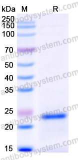 Recombinant Human SAT1 Protein, N-His