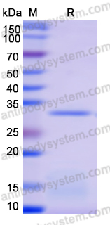 Recombinant Human SDHB Protein, N-His