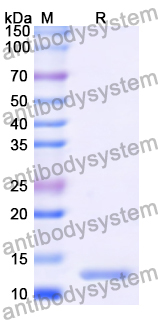 Recombinant Human CD9 Protein, C-His