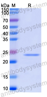 Recombinant Human KCNA4 Protein, N-His-SUMO