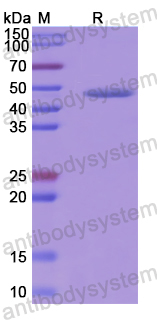 Recombinant Human UQCRC2 Protein, N-His