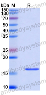 Recombinant Human SLC2A5 Protein, N-His-SUMO