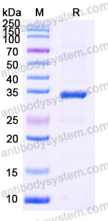 Recombinant Human CA4 Protein, C-His
