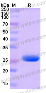 Recombinant Human LHCGR Protein, N-His