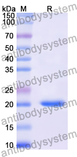 Recombinant Human CD49f/ITGA6 Protein, N-His