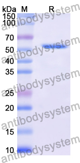 Recombinant Human TUBG1 Protein, N-His