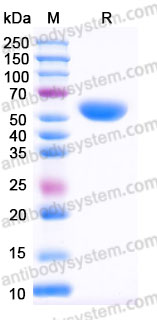 Recombinant Human WARS1 Protein, N-His