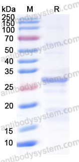 Recombinant Human SP100 Protein, N-His