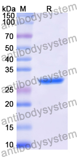 Recombinant Human MCC Protein, N-His