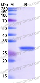 Recombinant Human ITPKA Protein, N-His
