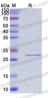 Recombinant Human VAMP1 Protein, N-His-SUMO