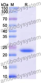 Recombinant Human PRPH2 Protein, N-His-SUMO & C-Strep
