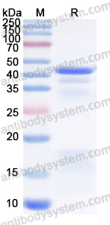 Recombinant Human FSHR Protein, N-His