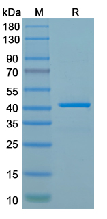 Recombinant Human TBXAS1 Protein, N-His
