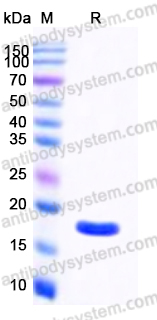 Recombinant Human ACP1 Protein, C-His