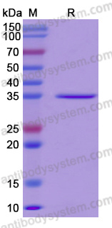 Recombinant Human CDK2 Protein, C-His