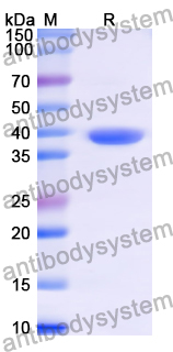 Recombinant Human TACR1 Protein, N-GST & C-His