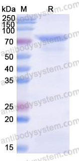 Recombinant Human MCM3 Protein, N-His