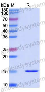 Recombinant Human RPS12 Protein, N-His