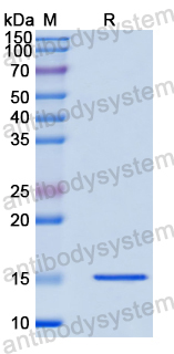 Recombinant Human BRD2 Protein, N-His