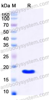 Recombinant Human YY1 Protein, C-His