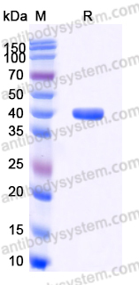 Recombinant Human HSP40/DNAJB1 Protein, C-His