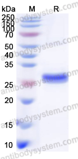Recombinant Human CTSS Protein, N-His