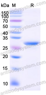 Recombinant Human NFKBIA Protein, N-His
