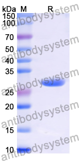 Recombinant Human ITGB7 Protein, N-His