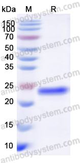 Recombinant Human DNMT1 Protein, N-His