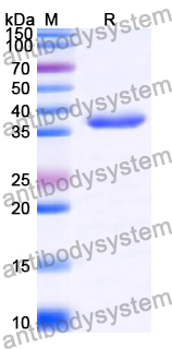 Recombinant Human ACRV1 Protein, N-GST & C-His