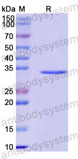 Recombinant Human HSD3B2 Protein, N-His