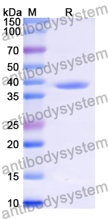 Recombinant Human S100A4 Protein, N-GST & C-His