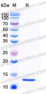 Recombinant Human S100A4 Protein, C-His